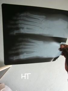 Les pieds de Paloulou en image